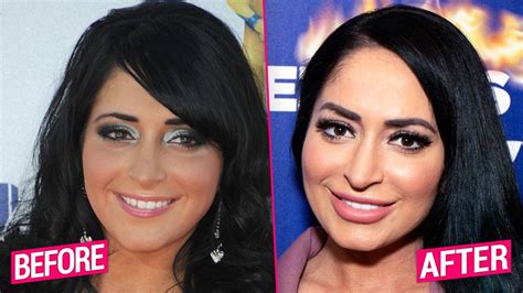 angelina pivarnick acne|Jersey Shore: Angelina admits to editing, filtering pictures, surgery